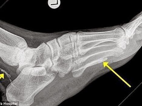 radiografia-2977967